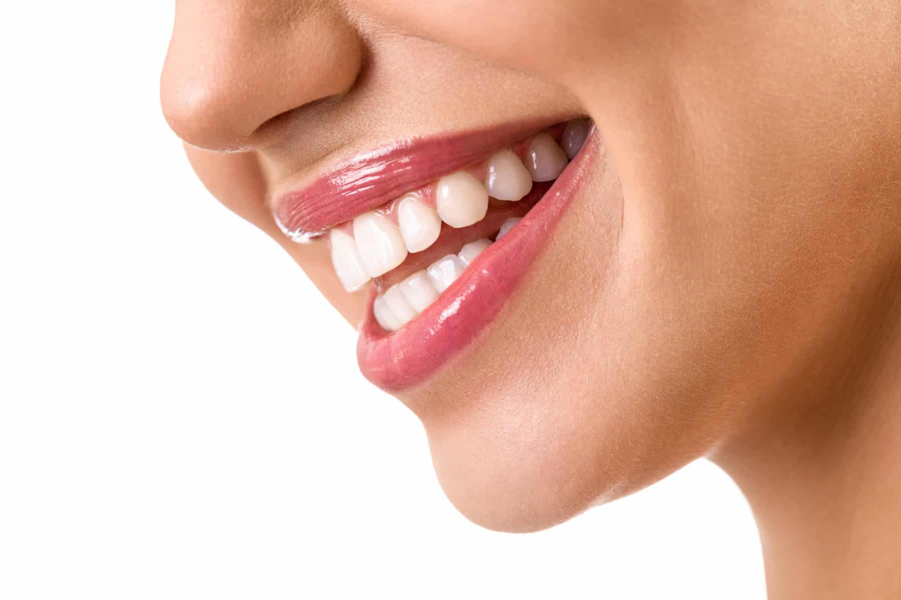Restored smile using composite dental bonding in Greenwood Village, CO